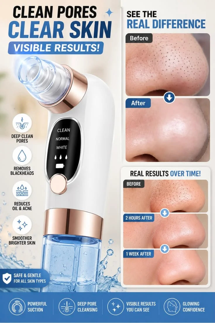 5-in-1 Rechargeable Blackhead Remover & Vacuum Facial Pore Cleaner